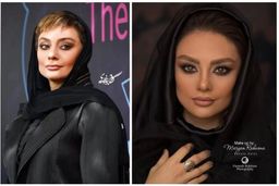 تغییر چهره شوکه کننده یکتا ناصر بعد از عمل چشمش | خانم از وقتی جدا شده چه به خودش میرسه