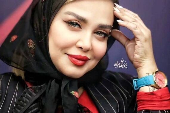 تغییر چهره باورنکردنی بهاره رهنما+عکس