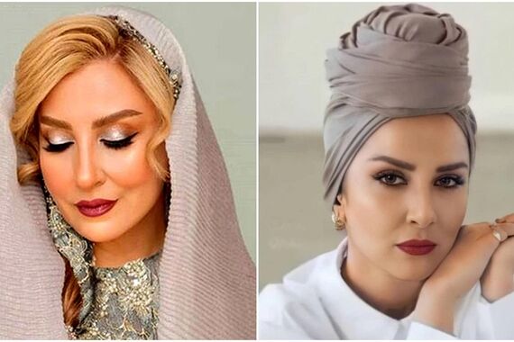 رونمایی مرجانه گلچین از چهره بعد از بوتاکسش | خانم با این حرکت 20 سال جوون شد