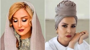 رونمایی مرجانه گلچین از چهره بعد از بوتاکسش | خانم با این حرکت 20 سال جوون شد