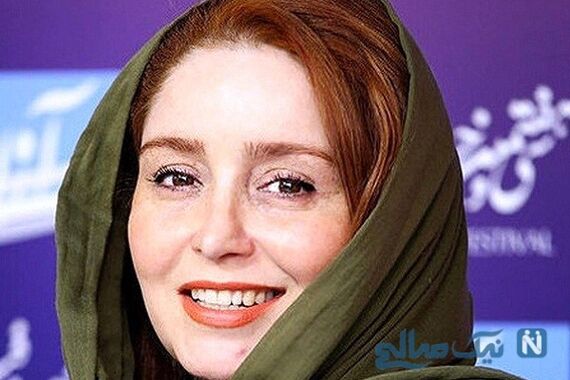 رونمایی ژاله صامتی از چهره بعد از عمل بینی اش | خانم با این تیپ گنگ تینیجریش همه رو مات خودش کرد