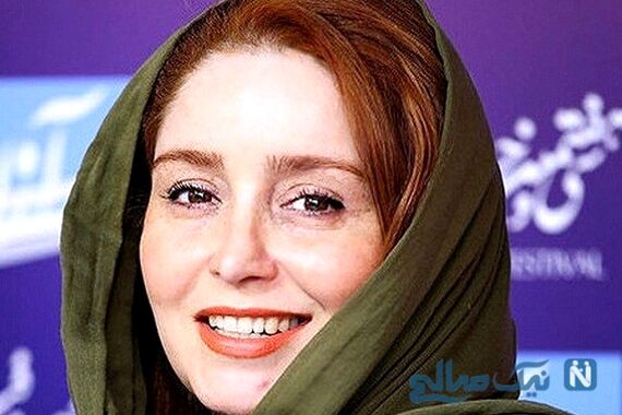 رونمایی ژاله صامتی از چهره بعد از عمل بینی اش | خانم با این تیپ گنگ تینیجریش همه رو مات خودش کرد