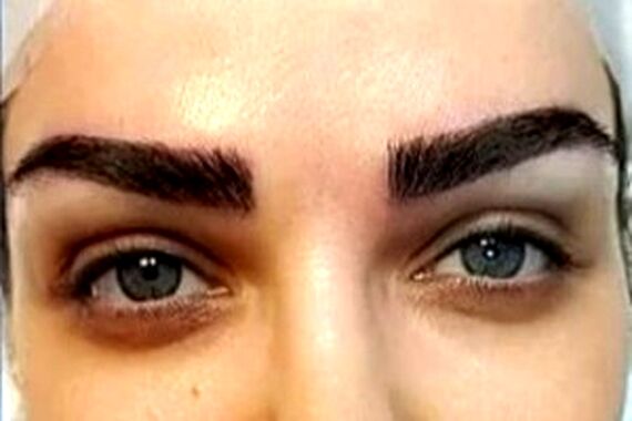 سلامت جسمی | پاکسازی موهای زائد با باقالی