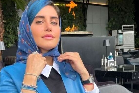 تیپ کوزتی الناز شاکردوست در ملاعام | خانم با این لباسای عجیبش حسابی سوژه شد