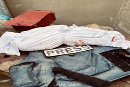 ببینید / تصویر دردناک از بقایای پیکر یک خبرنگار پس از شهادت