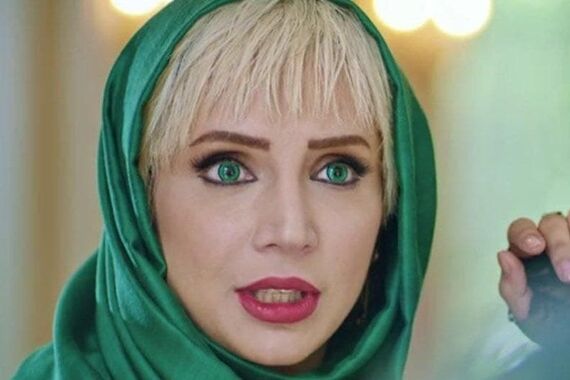 تغییر باورنکردنی شبنم قلی خانی بعد از عمل زیبایی | خانم کوبیده کلا از نو ساخته