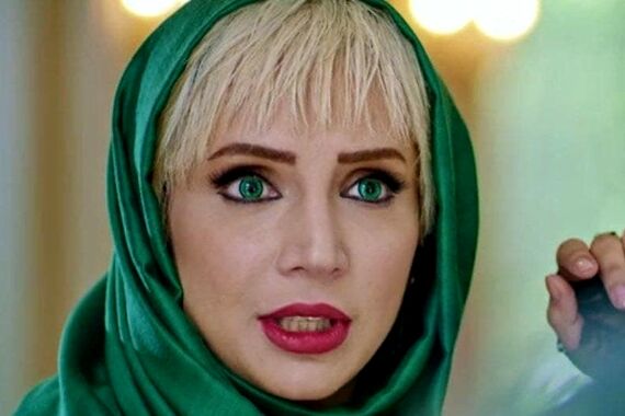 تغییر باورنکردنی شبنم قلی خانی بعد از عمل زیبایی | خانم کوبیده کلا از نو ساخته