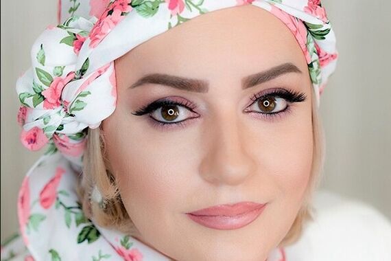 تصادف وحشتناک نعیمه نظام دوست | برای سلامتی نعیمه نظام دوست دعا کنید 